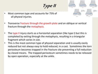 • Most common type and accounts for 75% of
all physeal injuries.
• Transverse fracture through the growth plate and an oblique or vertical
fracture through the metaphysis.
• The type II injury starts as a horizontal separation (like type I) but this is
completed by exiting through the metaphysis, resulting in a triangular
fragment which varies in size.
• This is the most common type of physeal separation and is usually easily
reduced but not always easy to hold reduced, in a cast. Sometimes the torn
periosteum becomes trapped in the fracture site preventing a full reduction
by closed means. The trapped periosteum sometimes needs to be released
by open operation, especially at the ankle.
TypeII
 