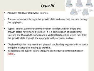 • Accounts for 8% of all physeal injuries.
• Transverse fracture through the growth plate and a vertical fracture through
the epiphysis.
• Type III injuries are more commonly seen in older children where the
growth plates have started to close. It is a combination of a horizontal
fracture line through the physis and a vertical fracture line which runs from
the growth plate through the epiphysis to the articular surface.
• Displaced injuries may result in a physeal bar, leading to growth disturbance
and joint incongruity, leading to arthritis.
• Most displaced type III injuries require open reduction internal fixation
(ORIF).
TypeIII
 