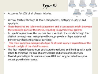 • Accounts for 10% of all physeal injuries.
• Vertical fracture through all three components, metaphysis, physis and
epiphysis.
• These fractures are liable to displacement and a consequent misfit between
the separated parts of the physis, resulting in asymmetrical growth
• In type IV separations, the fracture line is vertical. It extends through four
distinct tissues/areas: metaphyseal bone, physeal cartilage, epiphyseal
bone or cartilage and articular cartilage.
• The most common example of a type IV physeal injury is separation of the
lateral condyle of the distal humerus.
• The four injured tissues must be accurately reduced and lined up with each
other, to minimise the risk of a physeal bar and articular incongruity.
• Most displaced type IV injuries require ORIF and long-term follow-up to
detect growth disturbance.
TypeIV
 