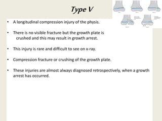 • A longitudinal compression injury of the physis.
• There is no visible fracture but the growth plate is
crushed and this may result in growth arrest.
• This injury is rare and difficult to see on x-ray.
• Compression fracture or crushing of the growth plate.
• These injuries are almost always diagnosed retrospectively, when a growth
arrest has occurred.
TypeV
 