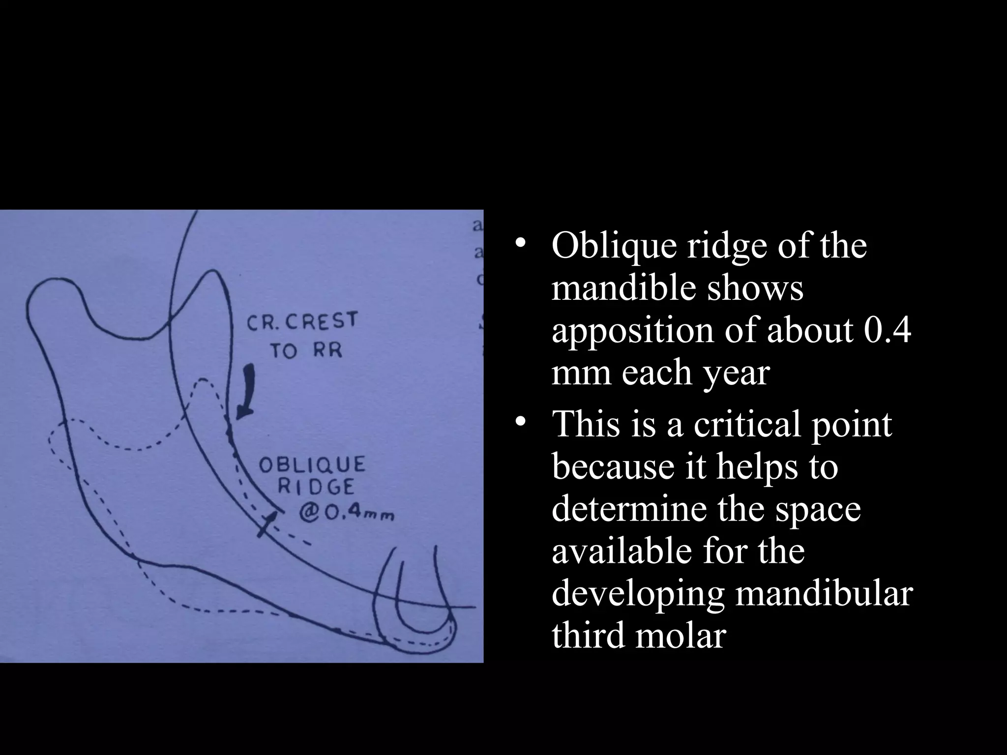 • Oblique ridge of the
mandible shows
apposition of about 0.4
mm each year
• This is a critical point
because it helps to
determine the space
available for the
developing mandibular
third molar
www.indiandentalacademy.com
 