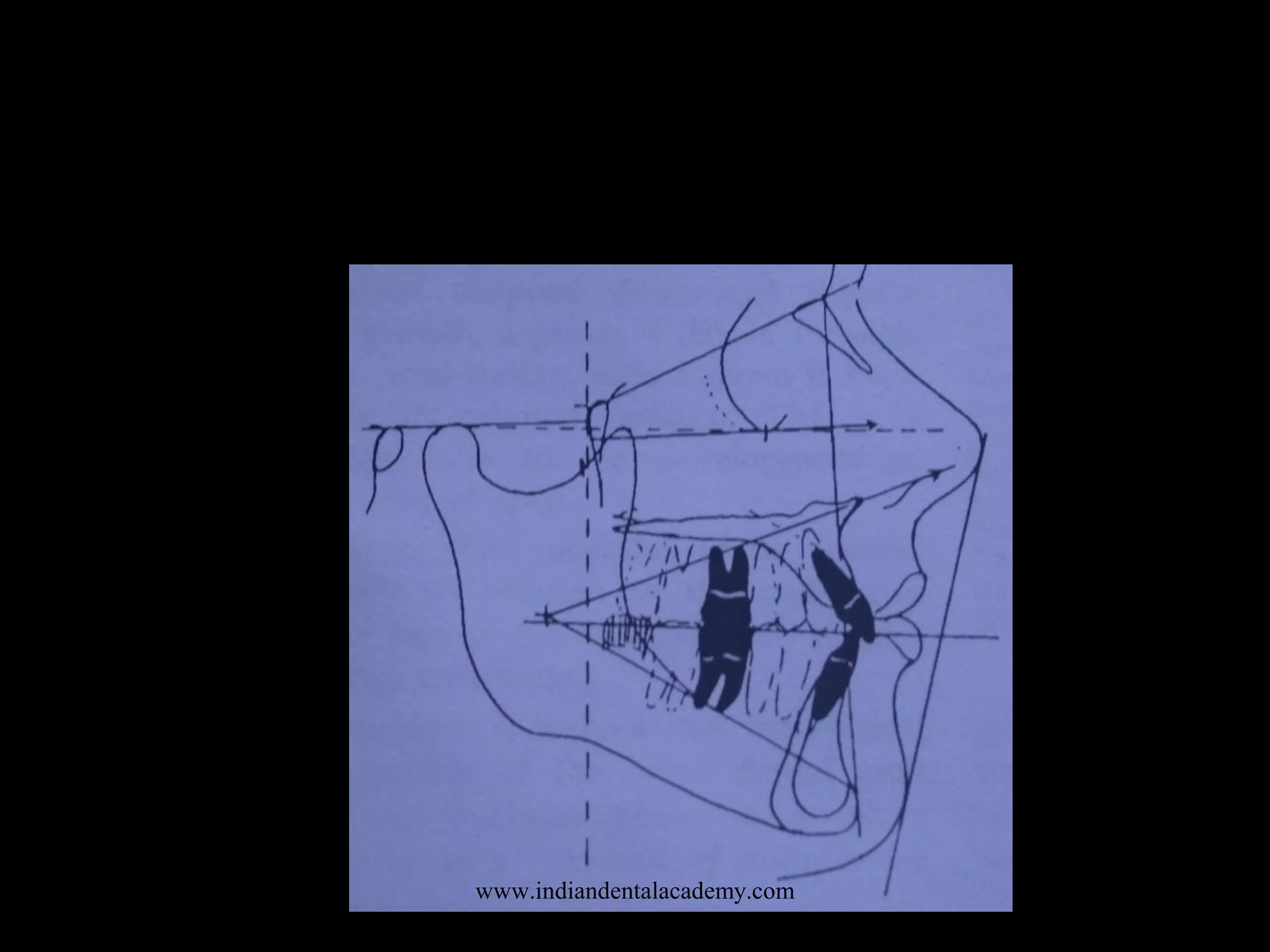 www.indiandentalacademy.com
 