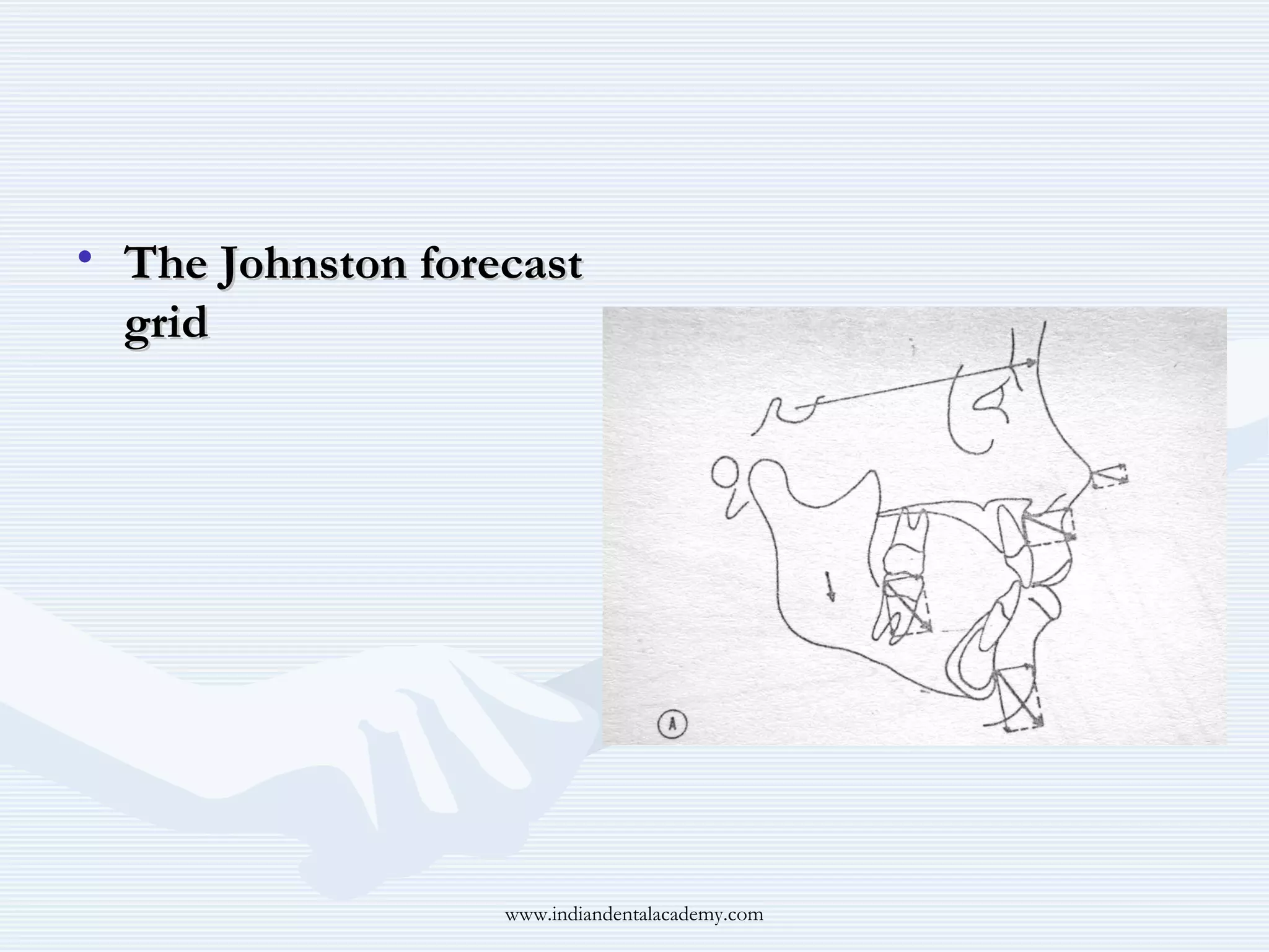 • The Johnston forecast
grid

www.indiandentalacademy.com

 