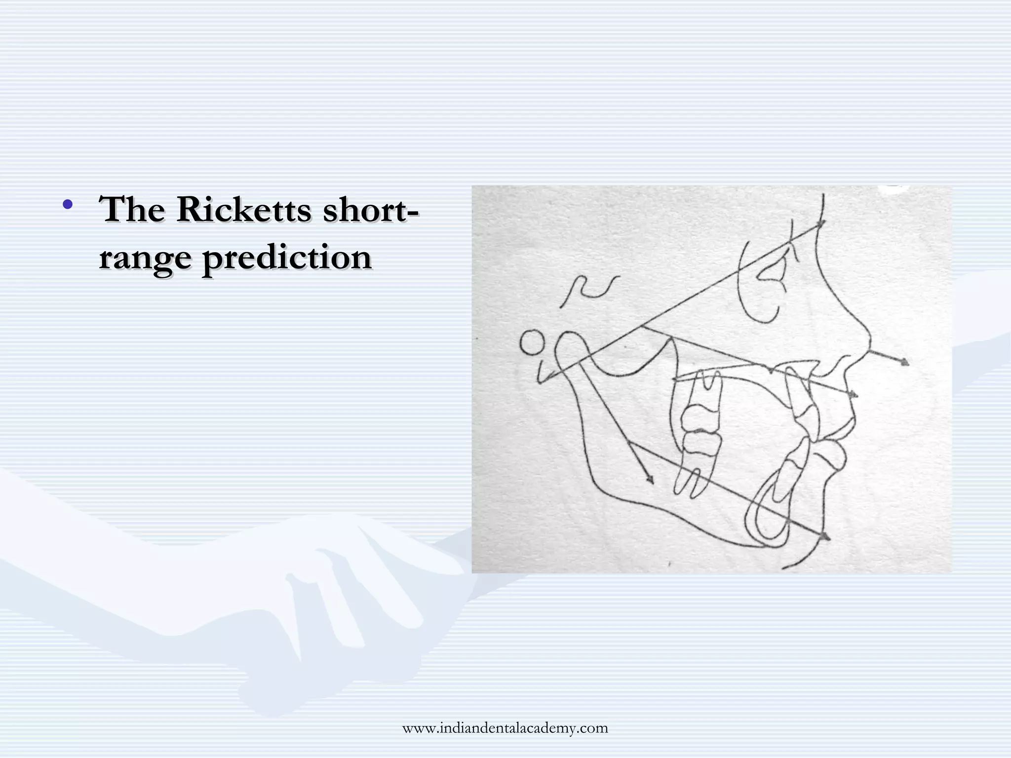 • The Ricketts shortrange prediction

www.indiandentalacademy.com

 
