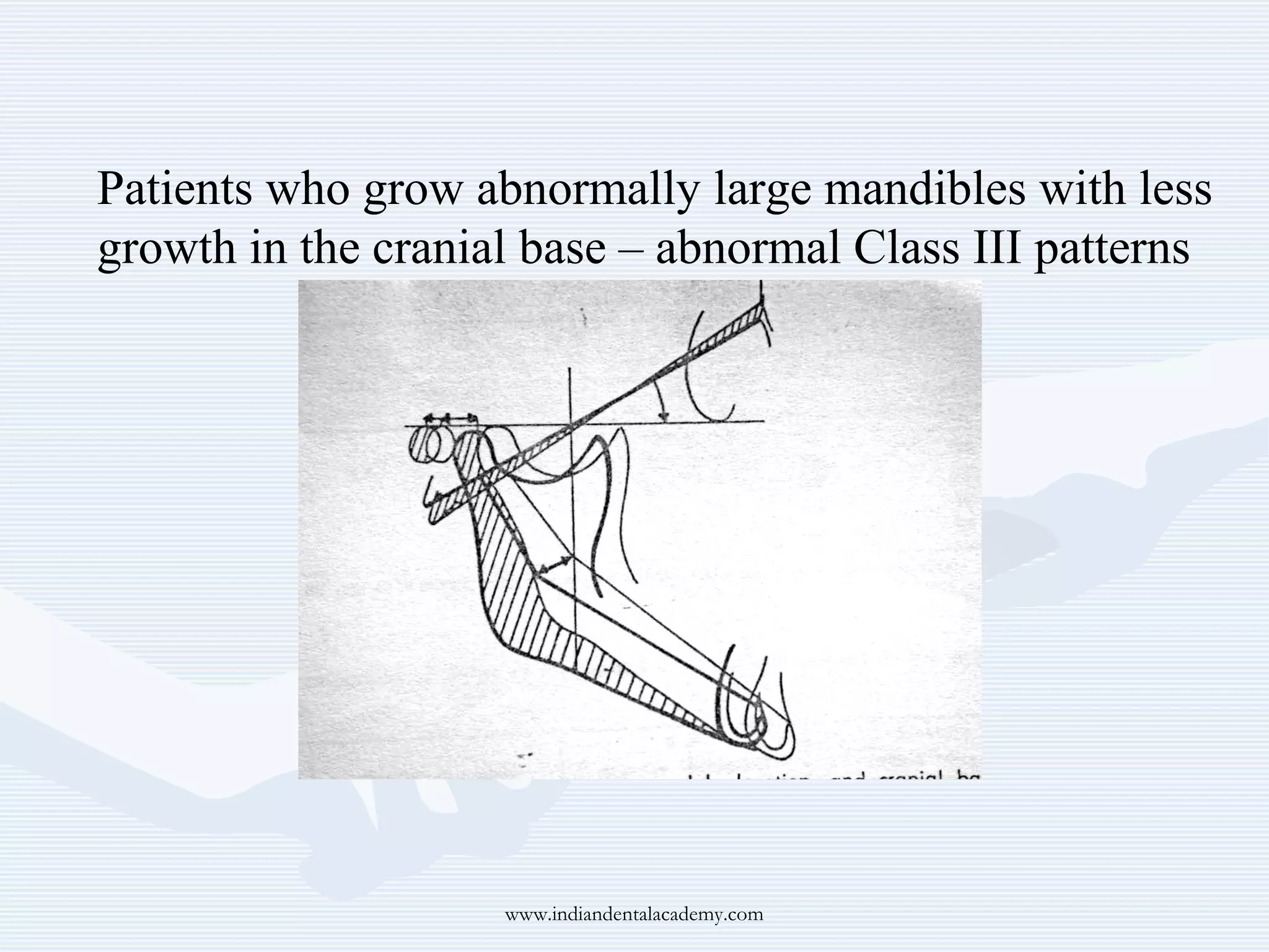 Patients who grow abnormally large mandibles with less
growth in the cranial base – abnormal Class III patterns

www.indiandentalacademy.com

 