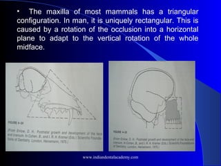 • The maxilla of most mammals has a triangular
configuration. In man, it is uniquely rectangular. This is
caused by a rotation of the occlusion into a horizontal
plane to adapt to the vertical rotation of the whole
midface.
www.indiandentalacademy.com
 