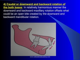 4) Caudal or downward and backward rotation of
the both bases: In relatively harmonious manner the
downward and backward maxillary rotation offsets what
could be an open bite created by the downward and
backward mandibular rotation.
www.indiandentalacademy.com
 