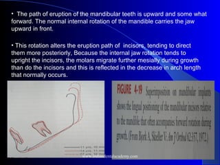 • The path of eruption of the mandibular teeth is upward and some what
forward. The normal internal rotation of the mandible carries the jaw
upward in front.
• This rotation alters the eruption path of incisors, tending to direct
them more posteriorly, Because the internal jaw rotation tends to
upright the incisors, the molars migrate further mesially during growth
than do the incisors and this is reflected in the decrease in arch length
that normally occurs.
www.indiandentalacademy.com
 