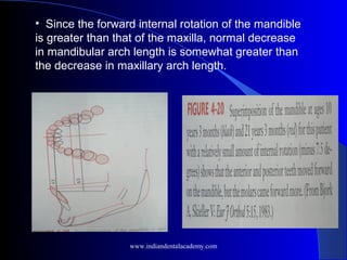• Since the forward internal rotation of the mandible
is greater than that of the maxilla, normal decrease
in mandibular arch length is somewhat greater than
the decrease in maxillary arch length.
www.indiandentalacademy.com
 