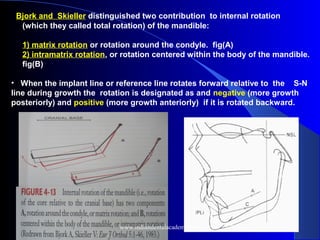 Bjork and Skieller distinguished two contribution to internal rotation
(which they called total rotation) of the mandible:
1) matrix rotation or rotation around the condyle. fig(A)
2) intramatrix rotation, or rotation centered within the body of the mandible.
fig(B)
• When the implant line or reference line rotates forward relative to the S-N
line during growth the rotation is designated as and negative (more growth
posteriorly) and positive (more growth anteriorly) if it is rotated backward.
www.indiandentalacademy.com
 