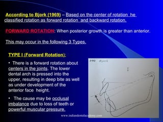 According to Bjork (1969) – Based on the center of rotation he
classified rotation as forward rotation and backward rotation.
FORWARD ROTATION: When posterior growth is greater than anterior.
This may occur in the following 3 Types.
TYPE I (Forward Rotation):
• There is a forward rotation about
centers in the joints. The lower
dental arch is pressed into the
upper, resulting in deep bite as well
as under development of the
anterior face height.
• The cause may be occlusal
imbalance due to loss of teeth or
powerful muscular pressure.
www.indiandentalacademy.com
 