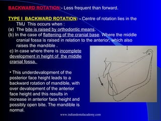 BACKWARD ROTATION:- Less frequent than forward.
TYPE I BACKWARD ROTATION: - Centre of rotation lies in the
TMJ This occurs when :
(a) The bite is raised by orthodontic means.
(b) In the case of flattening of the cranial base. Where the middle
cranial fossa is raised in relation to the anterior, which also
raises the mandible .
c) In case where there is incomplete
development in height of the middle
cranial fossa.
• This underdevalopment of the
posterior face height leads to a
backward rotation of mandible, with
over devalopment of the anterior
face height and this results in
increase in anterior face height and
possibly open bite. The mandible is
normal.
www.indiandentalacademy.com
 