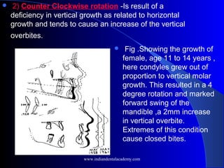  Fig .Showing the growth of
female, age 11 to 14 years ,
here condyles grew out of
proportion to vertical molar
growth. This resulted in a 4
degree rotation and marked
forward swing of the
mandible ,a 2mm increase
in vertical overbite.
Extremes of this condition
cause closed bites.
 2) Counter Clockwise rotation -Is result of a
deficiency in vertical growth as related to horizontal
growth and tends to cause an increase of the vertical
overbites.
www.indiandentalacademy.com
 
