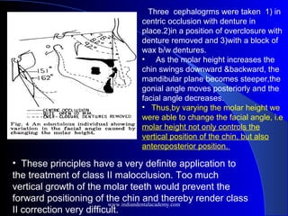 Three cephalogrms were taken 1) in
centric occlusion with denture in
place.2)in a position of overclosure with
denture removed and 3)with a block of
wax b/w dentures.
• As the molar height increases the
chin swings downward &backward, the
mandibular plane becomes steeper,the
gonial angle moves posteriorly and the
facial angle decreases.
• Thus,by varying the molar height we
were able to change the facial angle, i.e
molar height not only controls the
vertical position of the chin, but also
anteroposterior position.
• These principles have a very definite application to
the treatment of class II malocclusion. Too much
vertical growth of the molar teeth would prevent the
forward positioning of the chin and thereby render class
II correction very difficult.
www.indiandentalacademy.com
 