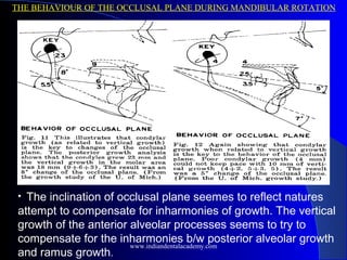 THE BEHAVIOUR OF THE OCCLUSAL PLANE DURING MANDIBULAR ROTATION
• The inclination of occlusal plane seemes to reflect natures
attempt to compensate for inharmonies of growth. The vertical
growth of the anterior alveolar processes seems to try to
compensate for the inharmonies b/w posterior alveolar growth
and ramus growth.
www.indiandentalacademy.com
 