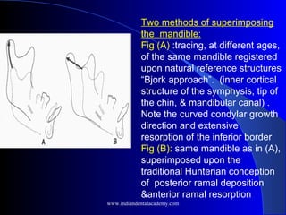 Two methods of superimposing
the mandible:
Fig (A) :tracing, at different ages,
of the same mandible registered
upon natural reference structures
“Bjork approach”. (inner cortical
structure of the symphysis, tip of
the chin, & mandibular canal) .
Note the curved condylar growth
direction and extensive
resorption of the inferior border
Fig (B): same mandible as in (A),
superimposed upon the
traditional Hunterian conception
of posterior ramal deposition
&anterior ramal resorption
www.indiandentalacademy.com
 