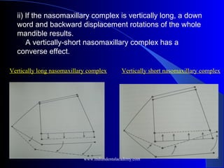 ii) If the nasomaxillary complex is vertically long, a down
word and backward displacement rotations of the whole
mandible results.
A vertically-short nasomaxillary complex has a
converse effect.
Vertically long nasomaxillary complex Vertically short nasomaxillary complex
www.indiandentalacademy.com
 