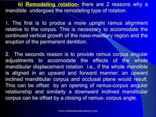 b) Remodeling rotation- there are 2 reasons why a
mandible undergoes the remodeling type of rotation.
1. The first is to prodce a more upright ramus alignment
relative to the corpus. This is necessary to accomodate the
continued vertical growth of the naso-maxillary region and the
eruption of the permanent dentition.
2. The seconds reason is to provide ramus corpus angular
adjustments to accomodate the effects of the whole
mandibular displacement rotation i.e., if the whole mandible
is aligned in an upward and forward manner, an upward
inclined mandibular corpus and occlusal plane would result.
This can be offset by an opening of ramus-corpus angular
relationship and similarly a downward inclined mandibular
corpus can be offset by a closing of ramus- corpus angle.
www.indiandentalacademy.com
 