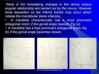 • Most of the remodeling changes in the ramus corpus
angular relationship are carried out by the ramus. However
bone deposition on the inferior bordor may occur which
rotates the mandibular plane inferiorly .
• A mandible characterically has a more prominent
antegonial notch, if the gonial angle opened. Fig (a)
• A mandible has a less prominent antegonial notch (fig
(b) if the gonial angle becomes closed.
www.indiandentalacademy.com
 