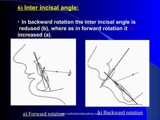 6) Inter incisal angle:
• In backward rotation the inter incisal angle is
redused (b), where as in forward rotation it is
increased (a).
a) Forward rotation b) Backward rotation
www.indiandentalacademy.com
 