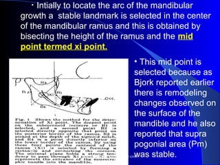 •  Intially to locate the arc of the mandibular
growth a stable landmark is selected in the center
of the mandibular ramus and this is obtained by
bisecting the height of the ramus and the mid
point termed xi point.
• This mid point is
selected because as
Bjork reported earlier
there is remodeling
changes observed on
the surface of the
mandible and he also
reported that supra
pogonial area (Pm)
was stable.
www.indiandentalacademy.com
 