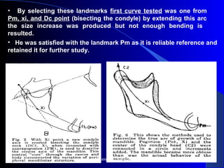 •   By selecting these landmarks first curve tested was one from
Pm, xi, and Dc point (bisecting the condyle) by extending this arc
the size increase was produced but not enough bending is
resulted.
• He was satisfied with the landmark Pm as it is reliable reference and
retained it for further study.
www.indiandentalacademy.com
 