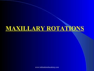 MAXILLARY ROTATIONS
www.indiandentalacademy.com
 