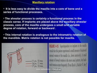 Maxillary rotation
• It is less easy to divide the maxilla into a core of bone and a
series of functional processes.
• The alveolar process is certainly a functional process in the
classic sense. If implants are placed above the maxillary alveolar
process, core of the maxilla undergoes a small and variable
degree of rotation, forward or backward .
• This internal rotation is analogous to the intramatrix rotation of
the mandible. Matrix rotation is not possible for maxilla.
www.indiandentalacademy.com
 