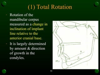 Maxilla Rotation Device growth rotation orthodontics mds pg mandible and maxilla | PPT