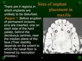 Maxilla Rotation Device growth rotation orthodontics mds pg mandible and maxilla | PPT