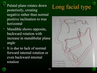 Mandibular Lateral Rotation growth rotation orthodontics mds pg mandible and maxilla | PPT