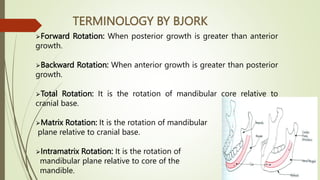 GROWTH ROTATION OF POST NATEL GROWTH OF MAXILLA.pptx