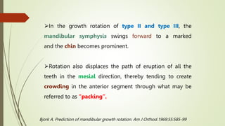 GROWTH ROTATION OF POST NATEL GROWTH OF MAXILLA.pptx