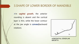 GROWTH ROTATION OF POST NATEL GROWTH OF MAXILLA.pptx