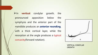 GROWTH ROTATION OF POST NATEL GROWTH OF MAXILLA.pptx