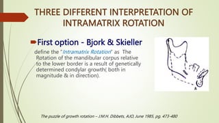 GROWTH ROTATION OF POST NATEL GROWTH OF MAXILLA.pptx