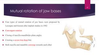 Maxilla Rotation Device growth rotations of mandible final.pdf