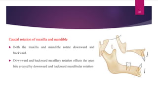 Maxilla Rotation Device growth rotations of mandible final.pdf