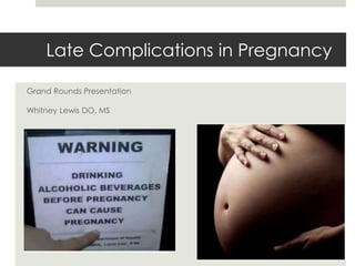 Late Complications in Pregnancy
Grand Rounds Presentation
Whitney Lewis DO, MS
 