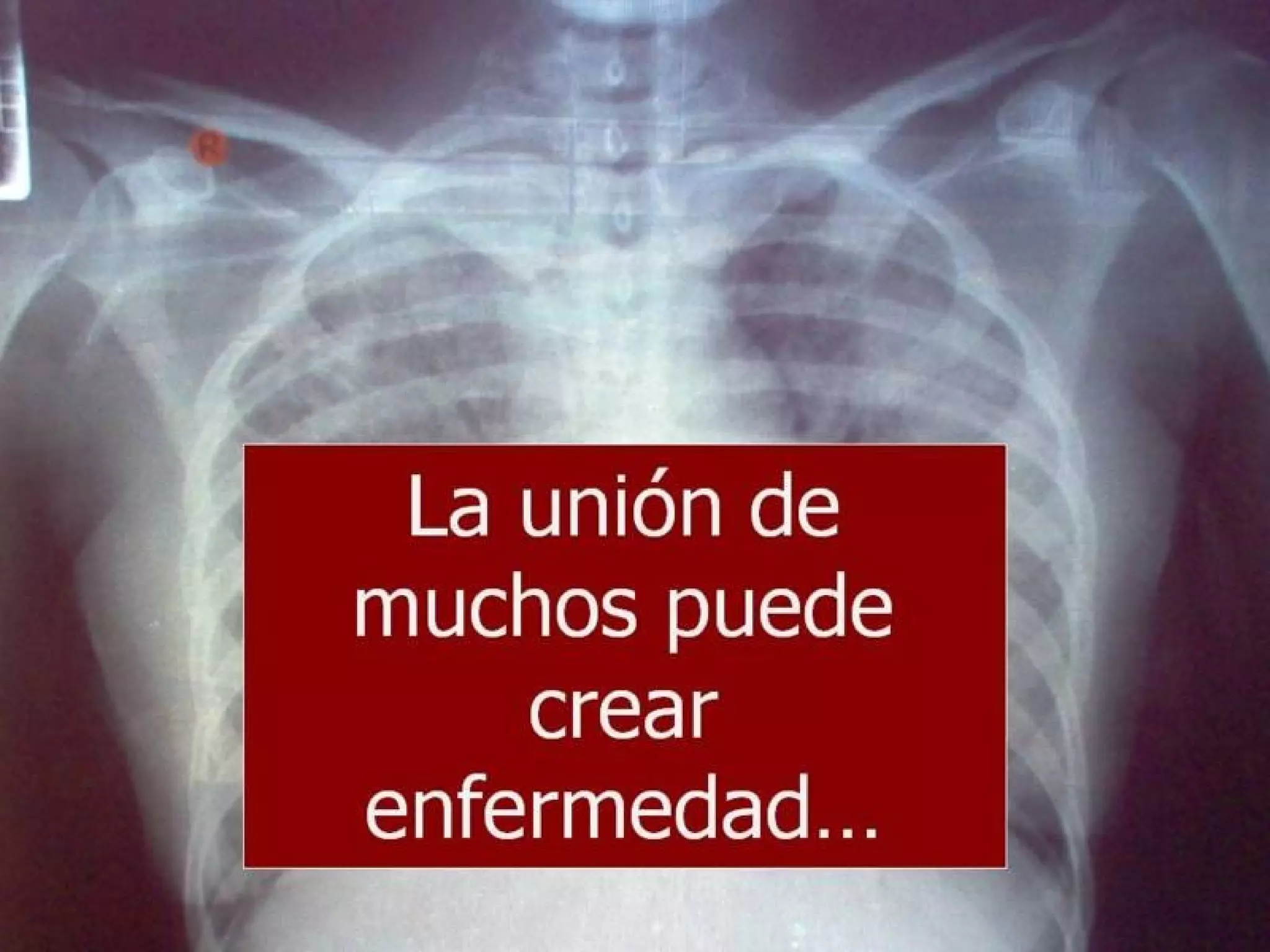 Grsb xarxa calent-pam-