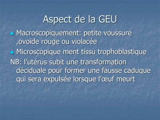 Aspect de la GEU
 Macroscopiquement: petite voussure
,ovoïde rouge ou violacée
 Microscopique ment tissu trophoblastique
NB: l’utérus subit une transformation
déciduale pour former une fausse caduque
qui sera expulsée lorsque l’œuf meurt
 
