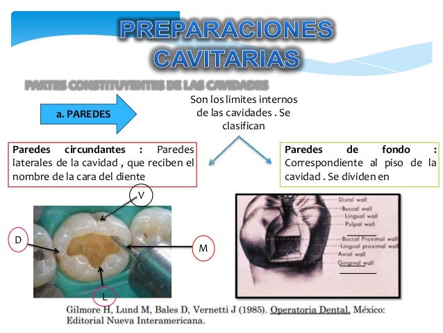 Preparaciones-Cavitarias