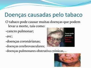 Doenças causadas pelo tabacoO tabaco pode causar muitas doenças que podem levar a morte, tais como:-cancro pulmonar;-avc;-doenças coronárianas;-doenças cerebrovasculares;-doenças pulmonares obstrutiva crónicas,…