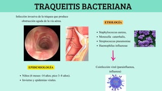 Traqueitis Rx Comprehensive Respiratory Semiología and Pediatric Respiratory ...