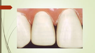 Grupo 19 2014 1 ODO 225