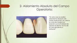 2- Aislamiento Absoluto del Campo
Operatorio:
“En este caso se realiza
aislamiento Absoluto del
modo tradicional y se coloca
la cuña de madera en
posición con la finalidad de
separar el diente vecino de
la cara del diente a
restaurar”
 