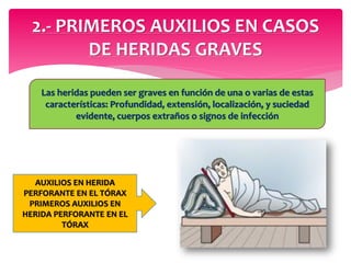2.- PRIMEROS AUXILIOS EN CASOS
DE HERIDAS GRAVES
Las heridas pueden ser graves en función de una o varias de estas
características: Profundidad, extensión, localización, y suciedad
evidente, cuerpos extraños o signos de infección
AUXILIOS EN HERIDA
PERFORANTE EN EL TÓRAX
PRIMEROS AUXILIOS EN
HERIDA PERFORANTE EN EL
TÓRAX
 