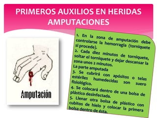 PRIMEROS AUXILIOS EN HERIDAS
AMPUTACIONES
 