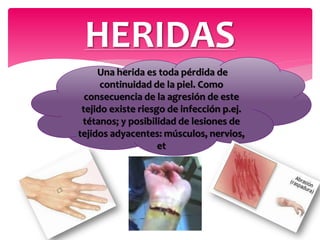 HERIDAS
Una herida es toda pérdida de
continuidad de la piel. Como
consecuencia de la agresión de este
tejido existe riesgo de infección p.ej.
tétanos; y posibilidad de lesiones de
tejidos adyacentes: músculos, nervios,
et
 