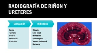 Radiografía sistema urinario SEGUNDO PARCIAL.pdf